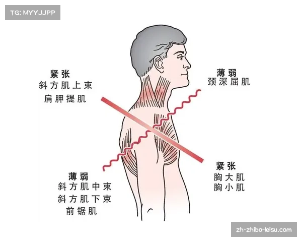 校园体育课推广姿势矫正贴片助力提升体育活动中的体态管理与不良体态预防